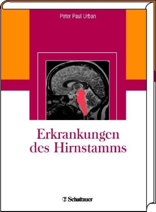 Erkrankungen des Hirnstamms