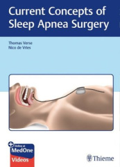 Current Concepts of Sleep Apnea Surgery