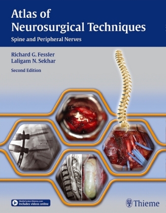 Atlas of Neurosurgical Techniques