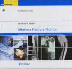 Minimax Fracture Fixation