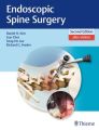 Endoscopic Spine Surgery