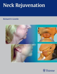 Neck Rejuvenation