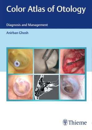 Color Atlas of Otology